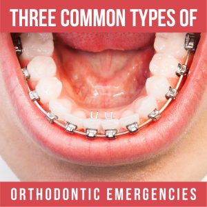 Atlanta orthodontist, Dr. Ceneviz at Chamblee Orthodontics discusses three common types of orthodontic emergencies, their symptoms, and how to handle them.