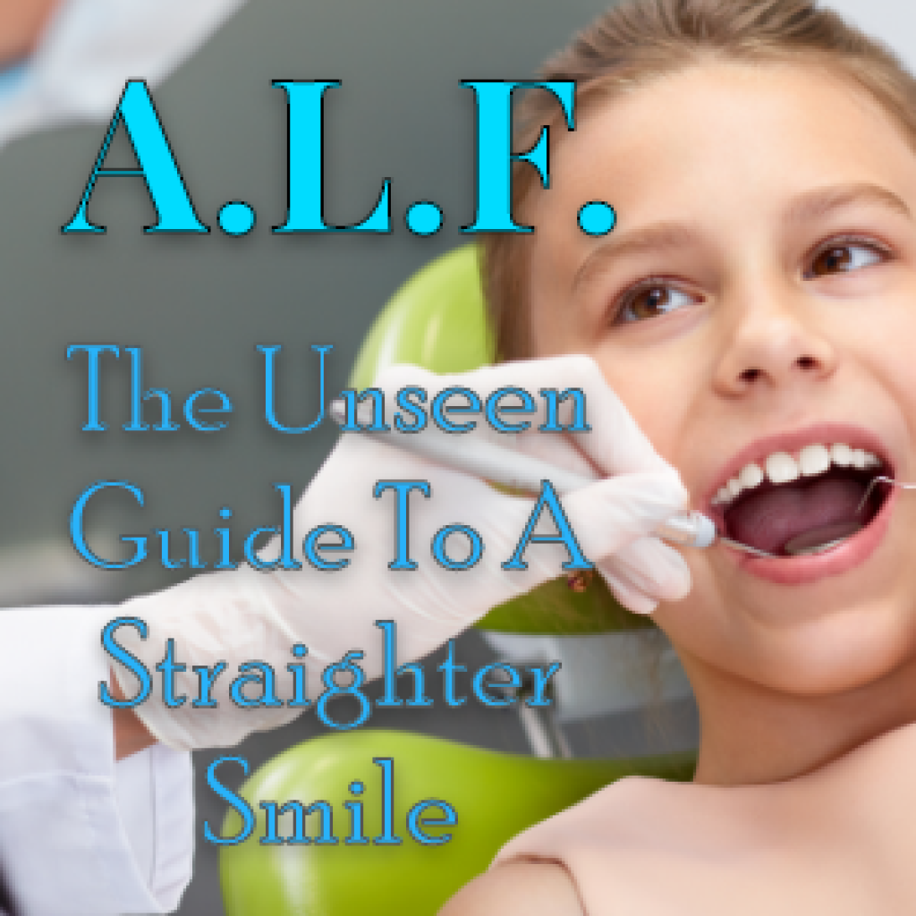 Advanced Lightwire Functional Appliance in Atlanta, GA Chamblee