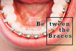 Atlanta dentist, Dr. Caroline Ceneviz at Chamblee Orthodontics explains how to maintain your oral hygiene while wearing braces.