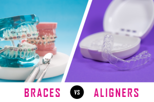Chamblee Orthodontics explain the difference between braces and aligners