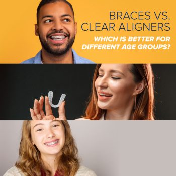 Atlanta dentist, Dr. Ceneviz at Chamblee Orthodontics, discusses braces and aligners- which are the better options for each different age group.