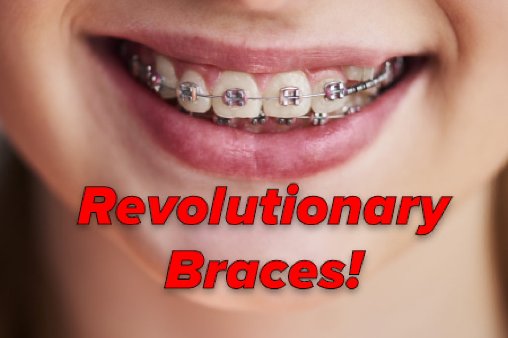 Damon Braces Chamblee Orthodontics Atlanta, GA