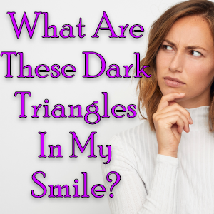 Looking for a solution to those pesky dark triangles between your teeth? Learn about their causes and the top four treatment options for dark triangles from Dr. Ceneviz at Chamblee Orthodontics in Atlanta.