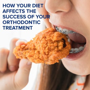 Atlanta dentist, Dr. Ceneviz at Chamblee Orthodontics, shares how your diet can impact your orthodontic journey. Read on to learn what to eat to help you effectively achieve a straighter smile.