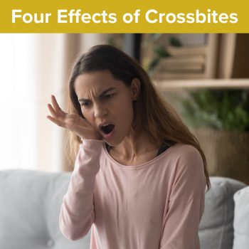 Atlanta dentist, Dr. Ceneviz at Chamblee Orthodontics, discusses the four effects of correcting crossbites. Read on to understand why it’s essential to correct this misalignment.