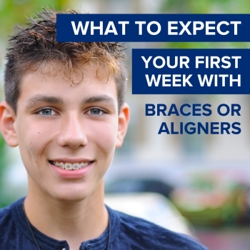 Nervous about getting braces or aligners? Atlanta dentist, Dr. Ceneviz at Chamblee Orthodontics, shares tips on what to expect in your first week and how to ease the transition.