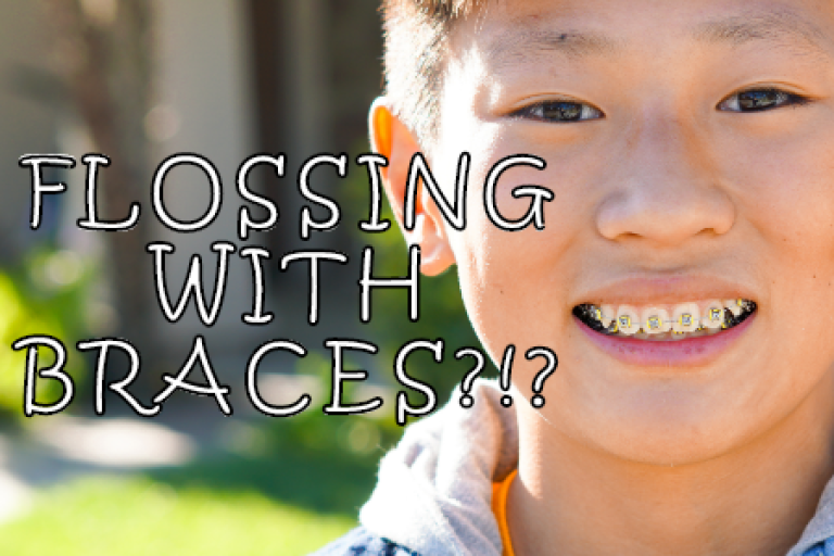 Can You Floss With Braces? Chamblee Orthodontics Atlanta, GA