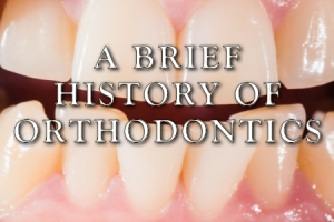 Atlanta dentist, Dr. Caaroline Ceneviz at Chamblee Orthodontics gives a brief history of orthodontics.