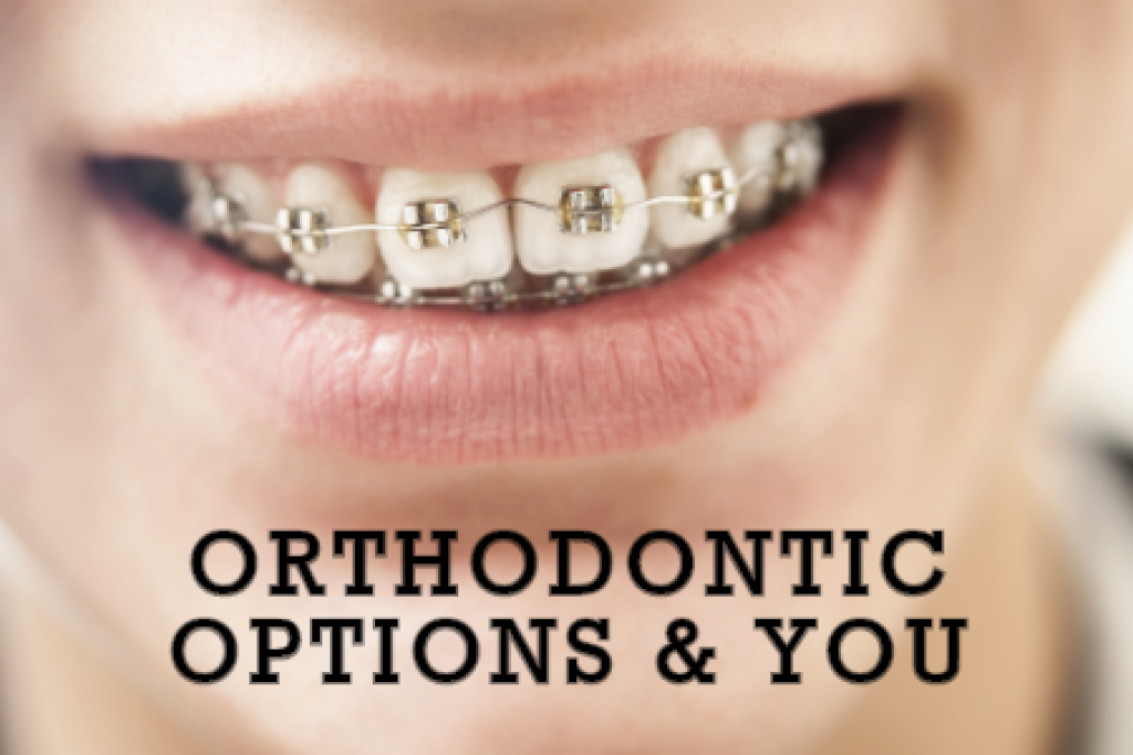 Orthodontic Options & You Chamblee Orthodontics Atlanta, GA