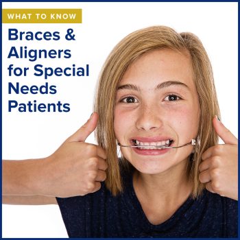 Atlanta dentist, Dr. Ceneviz at Chamblee Orthodontics, shares what you need to know about orthodontic treatment for special needs patients.