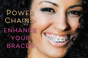 Atlanta Orthodontist, Dr. Ceneviz at Chamblee Orthodontics explains how Power Chains can improve your orthodontic outcome.