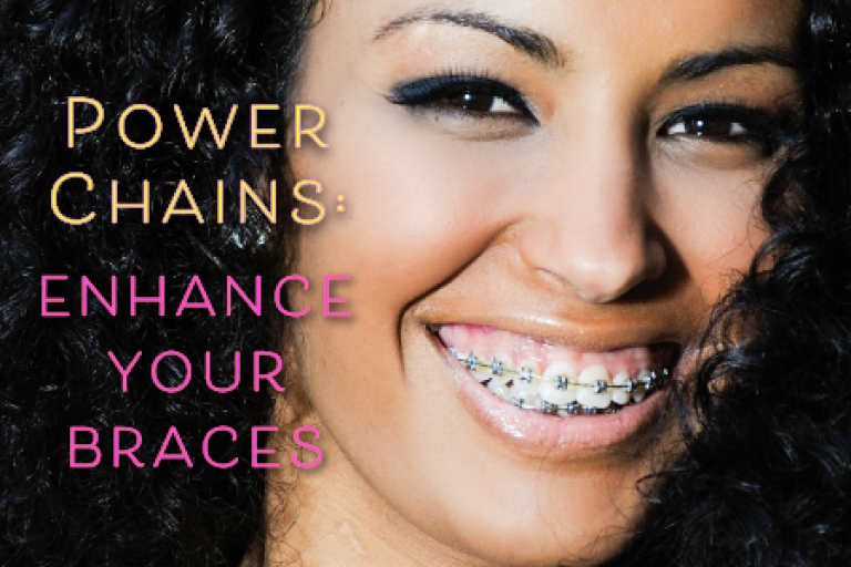 Enhance Your Braces With Power Chains in Atlanta, GA Chamblee