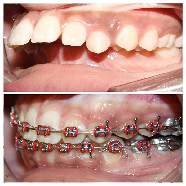 Before & After Photo