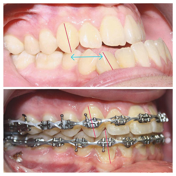 Before & After Photo