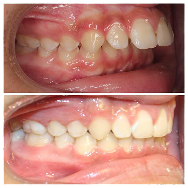 Before & After Photo