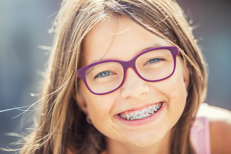 Traditional Braces Atlanta, GA, Self-Ligating Orthodontics