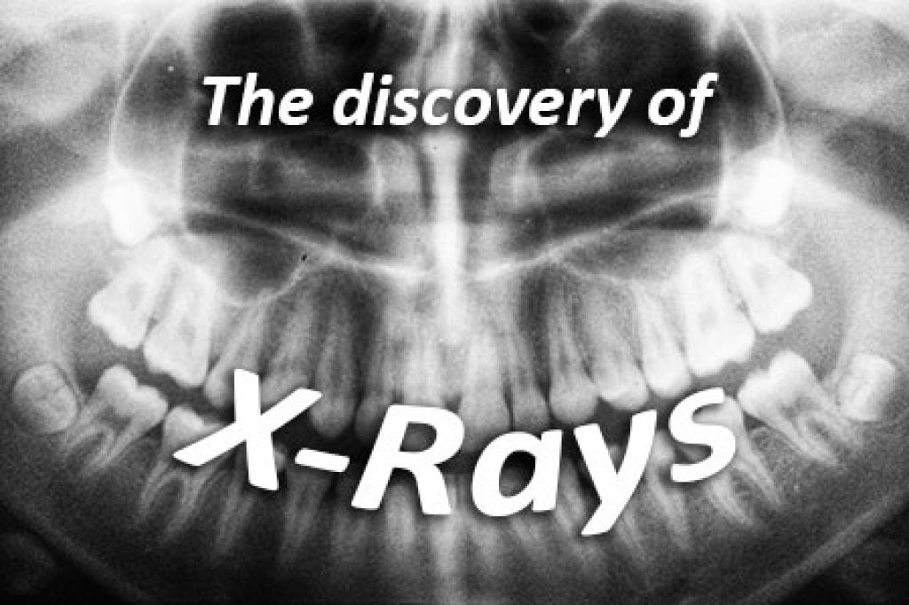 the-discovery-of-x-rays-in-atlanta-chamblee-orthodontics