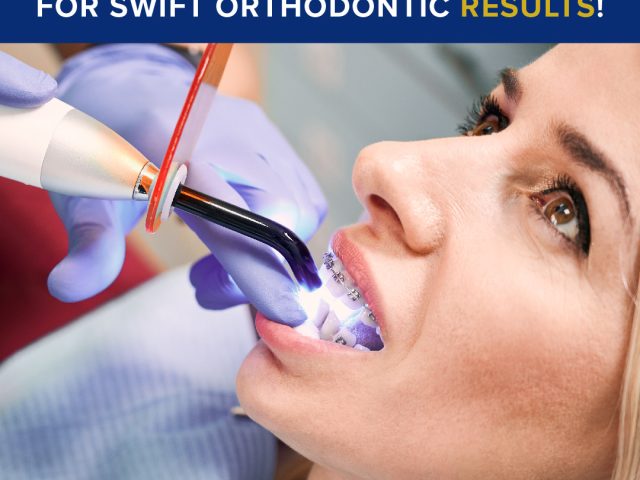 The Two Laser Techniques for Swift Orthodontic Results! (featured image)