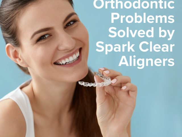 Three Orthodontic Problems Solved by Clear Aligners (featured image)