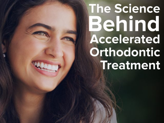 The Science Behind Accelerated Orthodontic Treatment: Is It Worth It? (featured image)