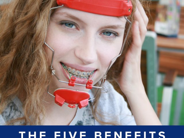 The Five Benefits Of Headgear Braces (featured image)