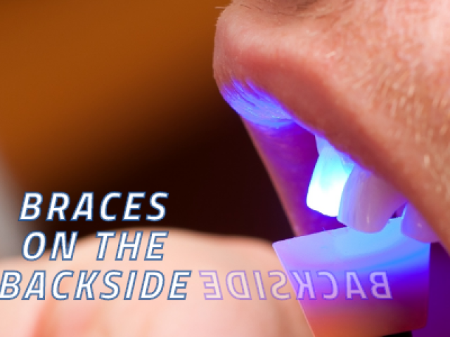 Braces On The Backside (featured image)