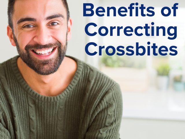 Four Benefits of Correcting Crossbites (featured image)