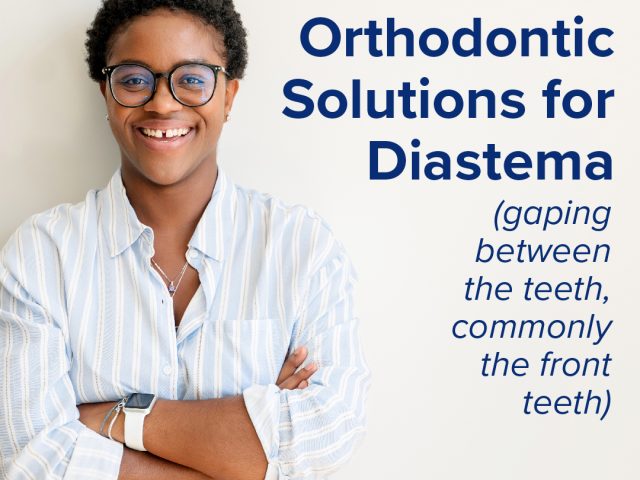 Three Orthodontic Solutions for Diastema (featured image)