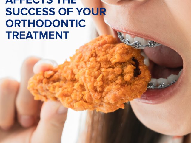 How Your Diet Affects the Success of Your Orthodontic Treatment (featured image)