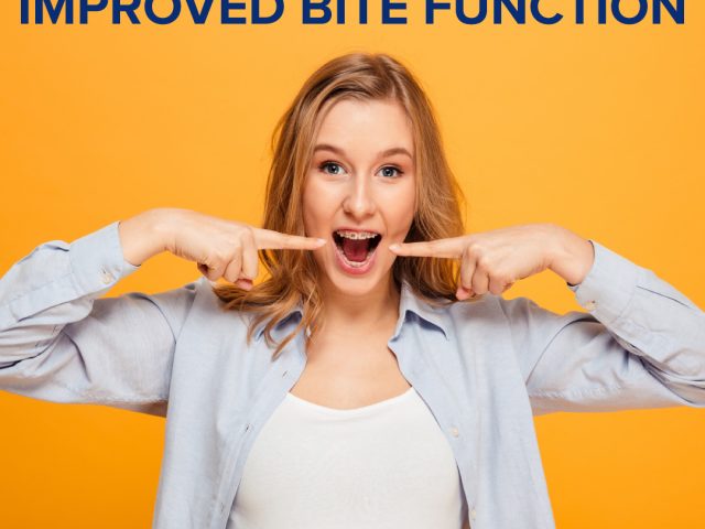 The Five Benefits of Improved Bite Function (featured image)