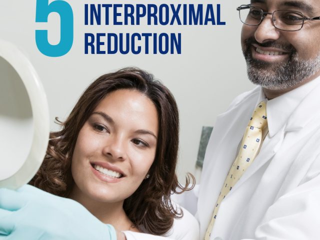 Four Benefits Of Interproximal Reduction (featured image)