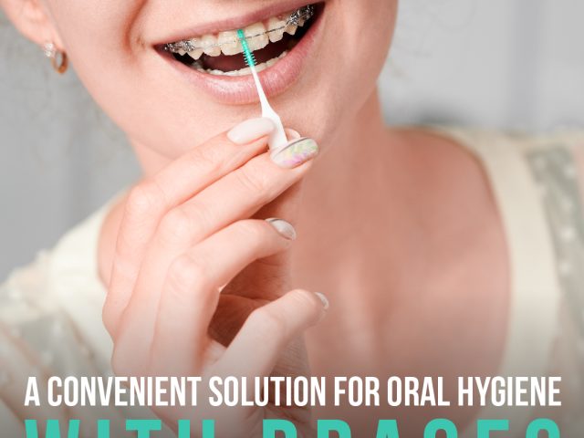 Orthodontic Flossers: A Convenient Solution for Oral Hygiene with Braces (featured image)