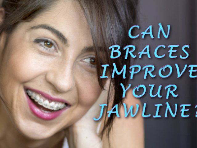 Can Orthodontics Improve Your Jawline? (featured image)