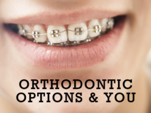 Orthodontic Options & You (featured image)