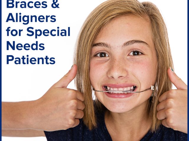 Braces and Aligners for Special Needs Patients: What to Know (featured image)