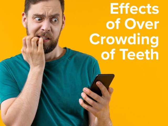 Four Effects of Overcrowding Of Teeth (featured image)