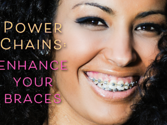 Enhance Your Braces With Power Chains (featured image)