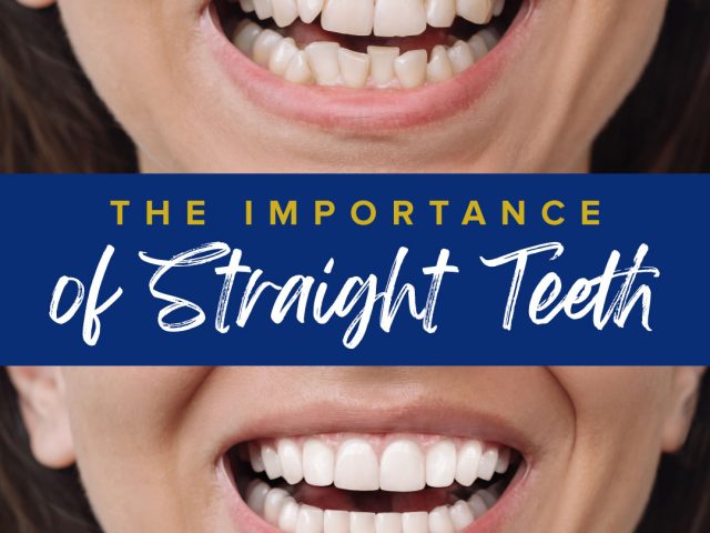The Importance of Straight Teeth for Your Health (featured image)