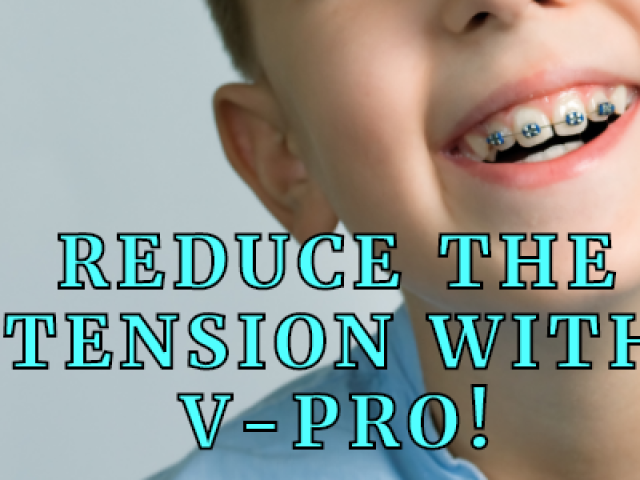 Is Vpro worth it? (featured image)